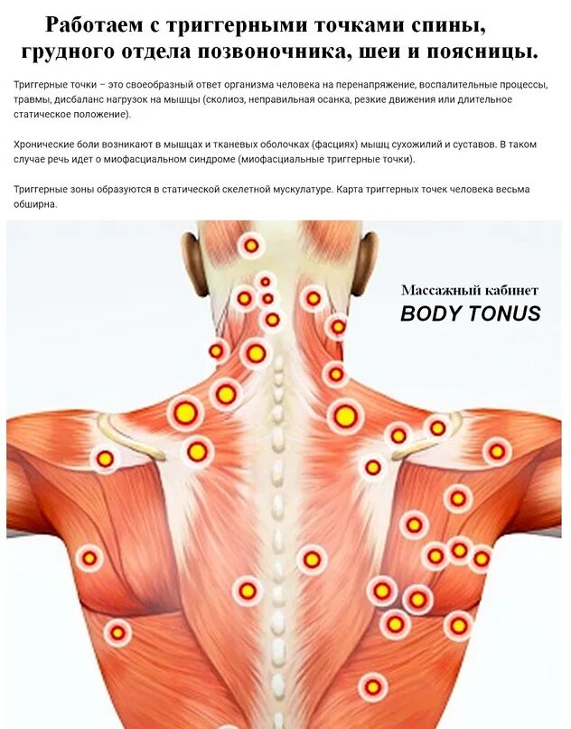 Триггерные точки поясницы. Триггерные точки на спине. Триггерная точка поясницы. Триггерная точка воротниковой зоны. Тнигерные точки пояснице.