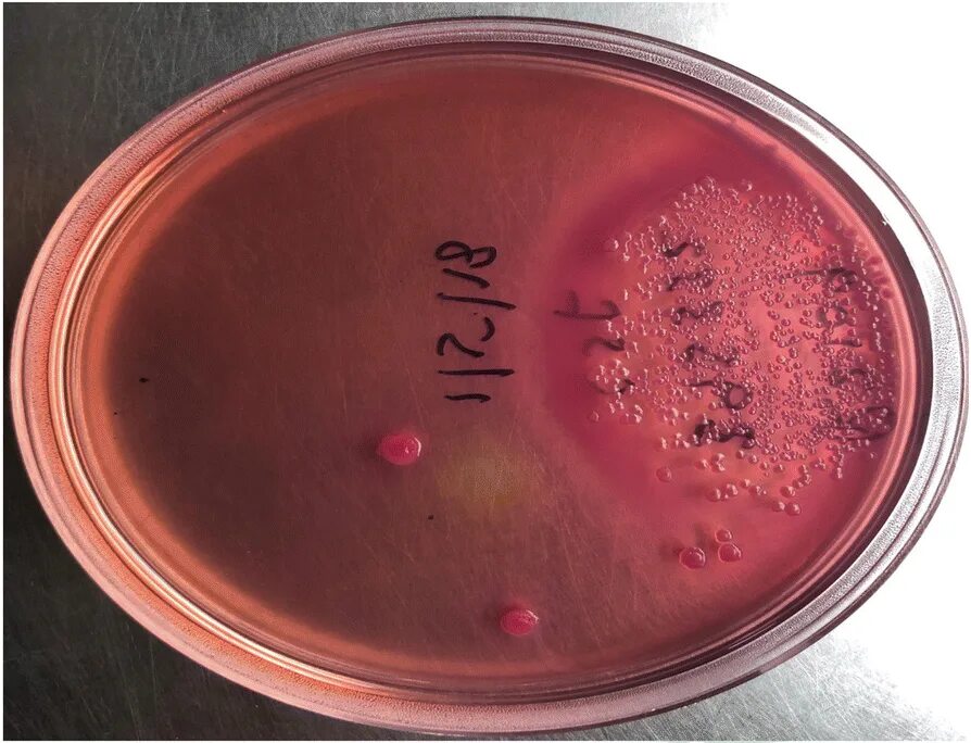 Coli sotwe. Эшерихии на Плоскирева. Шигеллы на Плоскирева. Среда Плоскирева Escherichia coli. Эшерихии на среде Плоскирева.