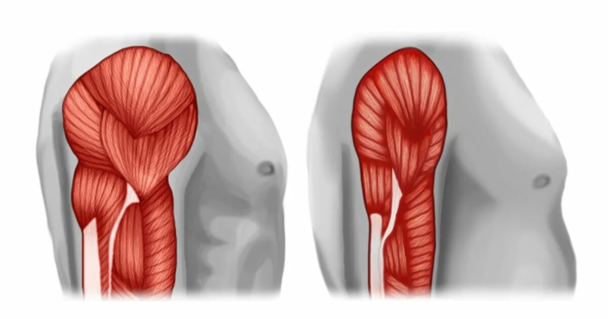 Мышцы тревоги. Комплекс упражнений на расслабление мышц. Мфбс малой грудной мышцы симптомы. Лестничная мышца и грудино ключично сосцевидная. Мышцы шеи.