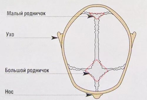 Когда затягивается родничок. Малый Родничок у новорожденных расположен. Большой и малый Родничок у новорожденного. Открытый малый Родничок. Большой Родничок у новорожденного.