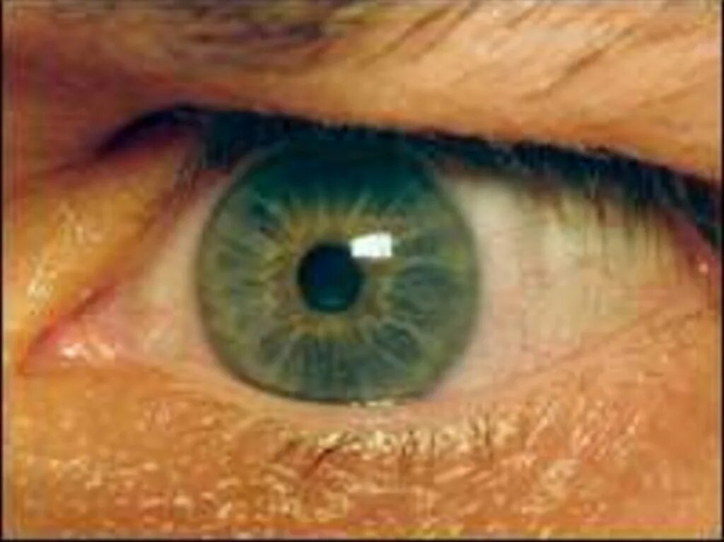 Пожелтение склер гепатит. Почему глаза желтые причина