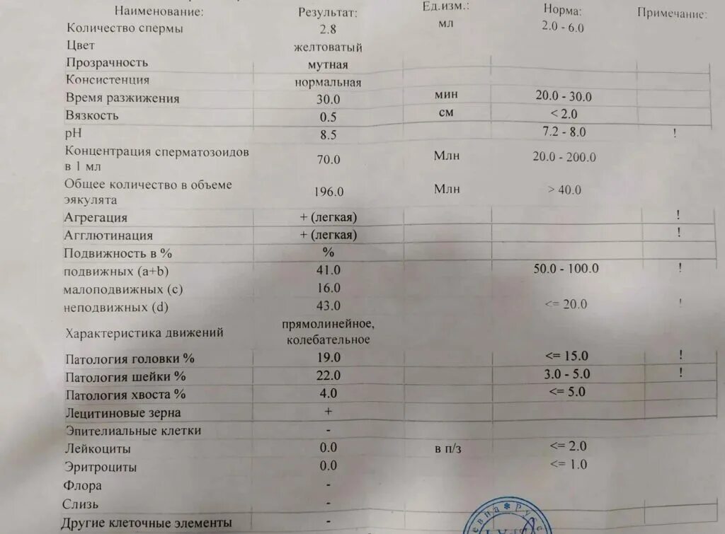Спермограмма анализ. Спермограмма с морфологией по крюгеру. Эритроциты в спермограмме. Клетки сперматогенеза в спермограмме. Спермограмма.