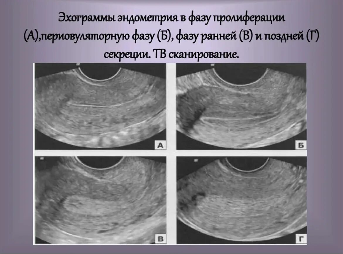 Разрастается эндометрий. Трехслойная структура эндометрия (УЗИ). Эндометрия пролиферативная фаза УЗИ. Эндометрий по фазам цикла на УЗИ.