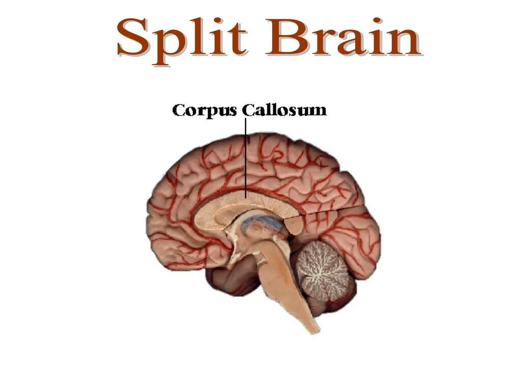 Split brain. Corpus callosum. Мозолистое тело головного мозга. ЭМОДЖИ мозг.