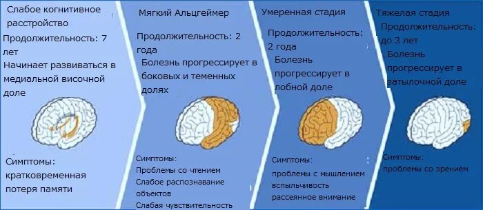 Стадии деменции форум. Стадии развития болезни Альцгеймера. Этапы болезни Альцгеймера. Фазы болезни Альцгеймера. Деменция этапы болезни.