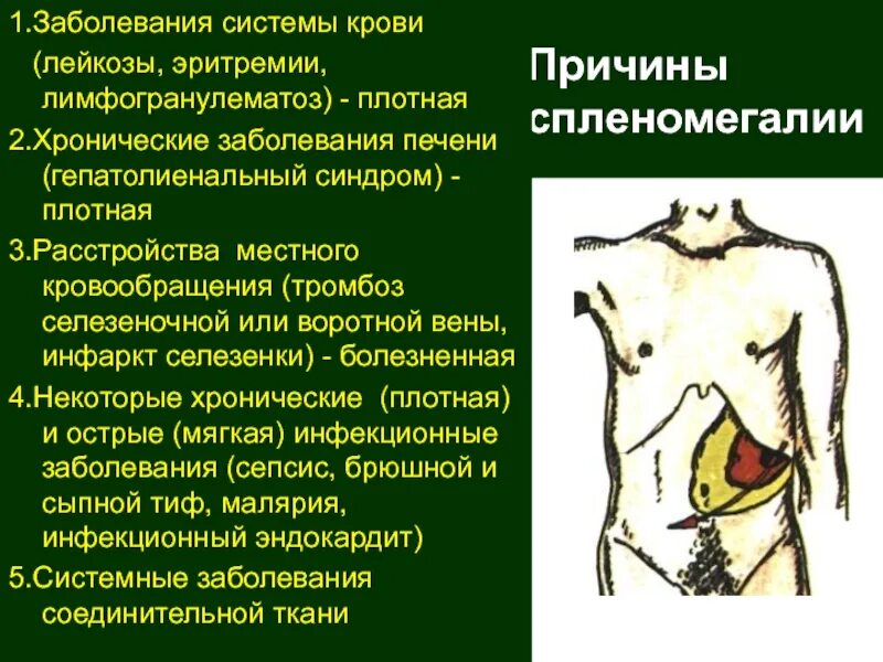 Септическая селезенка патогенез. Увеличенная селезенка у ребенка 1 год. Спленомегалия заболевания. Причины гиперспленизма. Симптомы патологии селезенки.