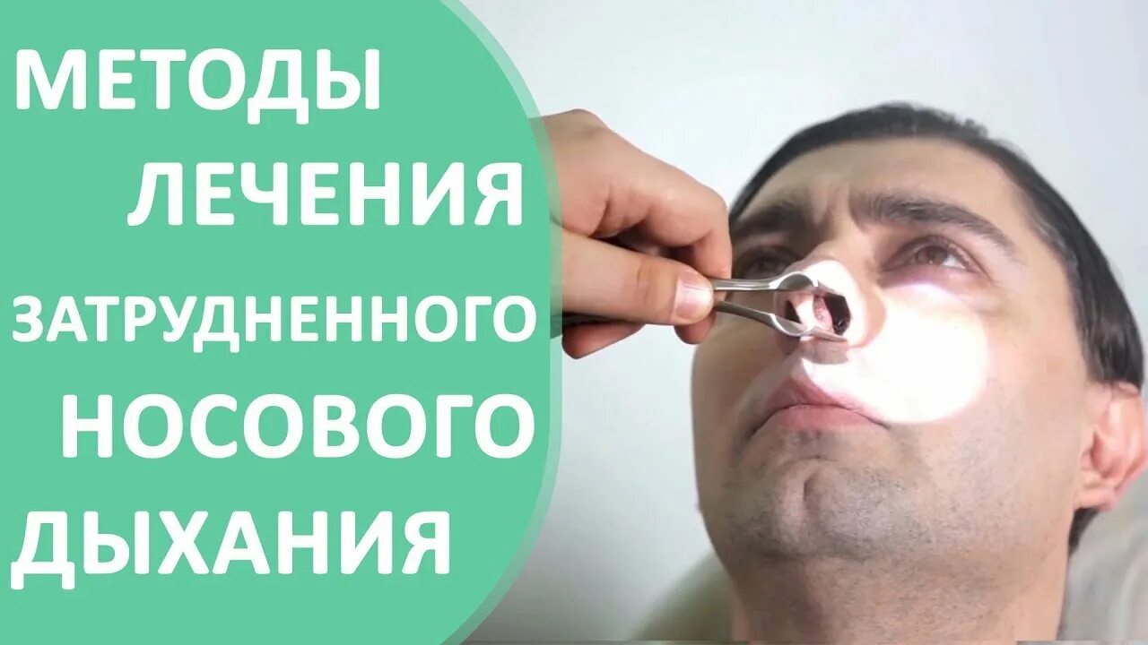 Как очистить заложенный нос. Закладывает нос трудно дышать что делать. Полипозный риносинусит. Полипы околоносовых пазух. Носовое дыхание затруднено.