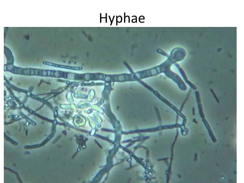 Споры гриба и нити. Мицелий гриба микроскопия. Мицелий грибов кожи микроскопия. Поверхностная трихофития микроскопия.