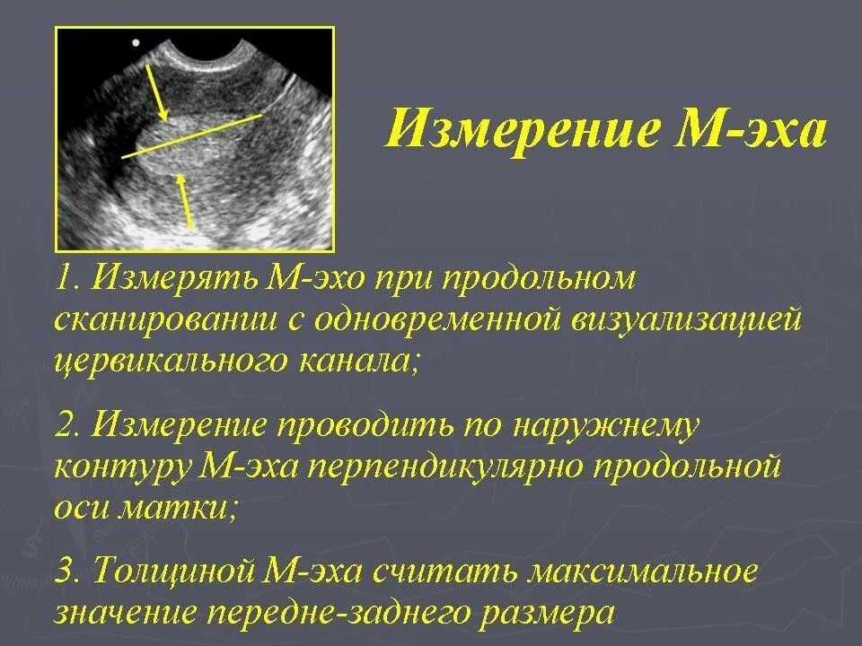 Эхо в гинекологии