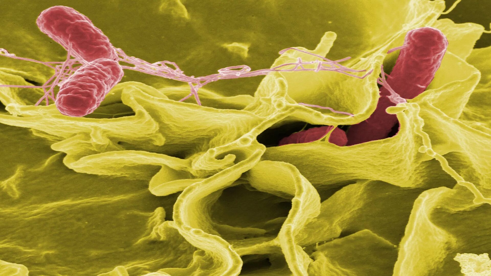 Сальмонелла. Salmonella под микроскопом. Сальмонеллез. Сальмонеллез фото. Микроорганизмы женских половых органов