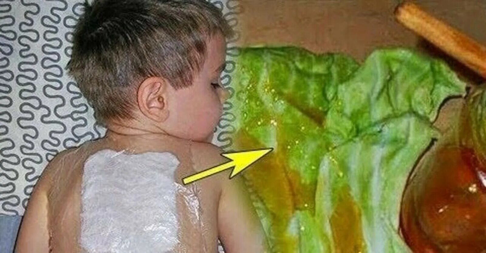 Капустный лист на грудную клетку