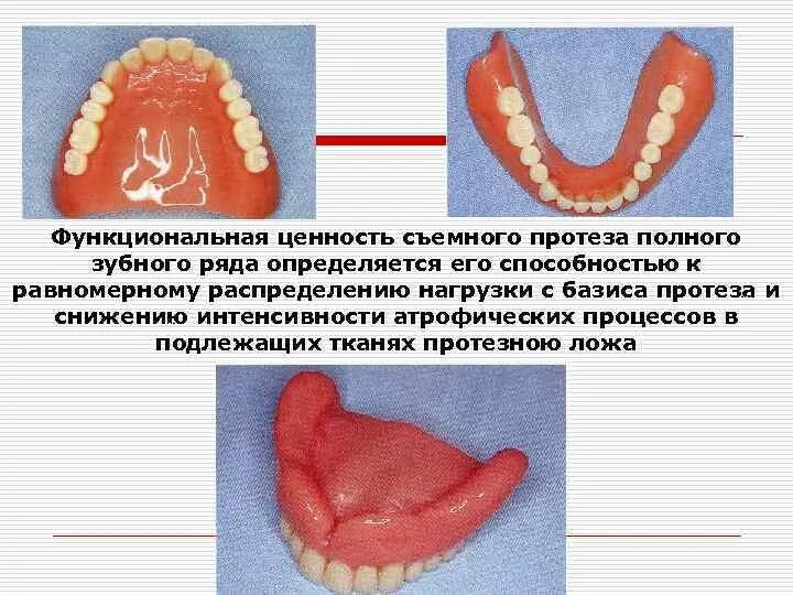 Толщина базиса. Реакция тканей протезного ложа на полные съемные протезы. Толщина базиса съемного протеза. Границы базиса полного съемного протеза.