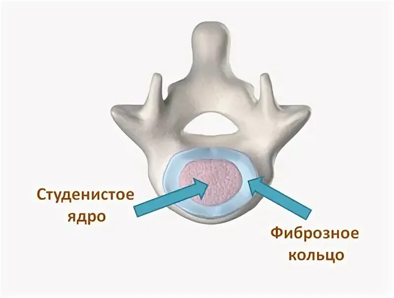 Содержимое межпозвоночного диска. Студенистое ядро межпозвоночного диска. Фиброзное кольцо и студенистое ядро. Фиброзное кольцо позвоночника. Студенистое ядро и пульпозное ядро.