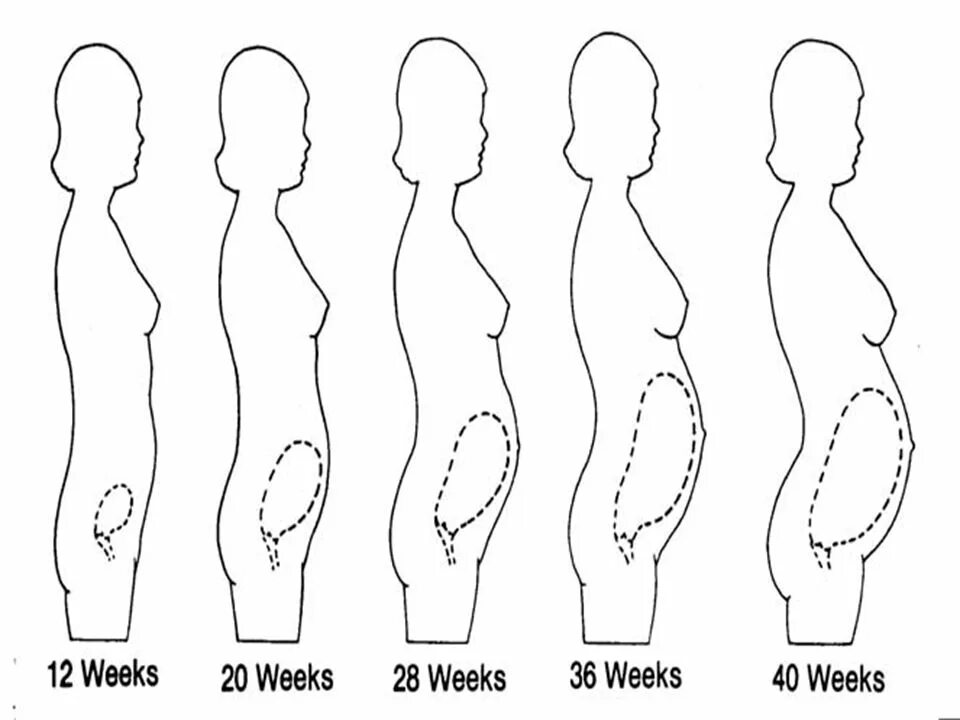 Матка в 15 недель. Матка в животе по неделям беременности. Расположение матки по неделям. Расположение матки по неделям беременности. Размер матки на 10 неделе беременности.