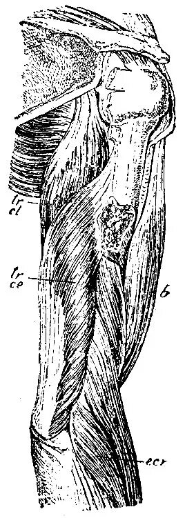 Тенодез сухожилия длинной головки бицепса. Тенодез длинной головки бицепса плечевого сустава. Тенотомия тенодез длинной головки бицепса плечевого сустава.