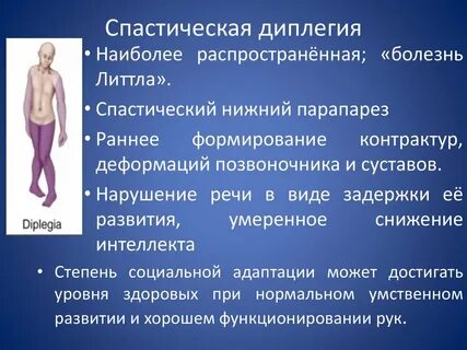 Нижняя параплегия