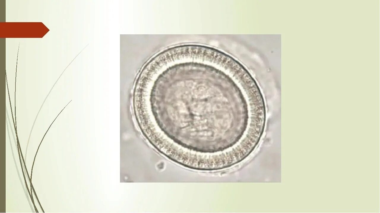 Онкосфера карликовый цепень. Яйца свиного цепня микроскоп. Строение яйца бычьего цепня. Яйцо (онкосфера) тениид. Яйцо с онкосферой