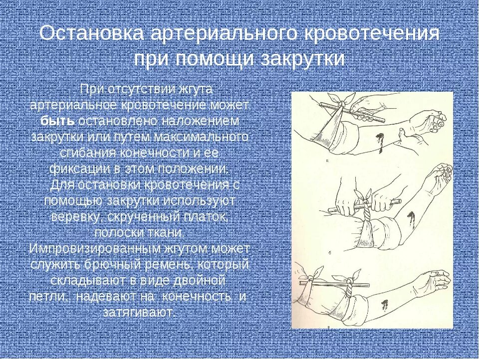 Артериальное кровотечение подручные средства. Остановка артериального кровотечения. Метод остановки артериального кровотечения. Методы остановки артериального кровотечения алгоритм. Наложение закрутки при кровотечении.