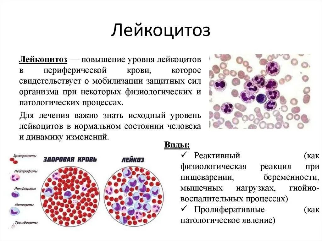 5 лейкоцитоз