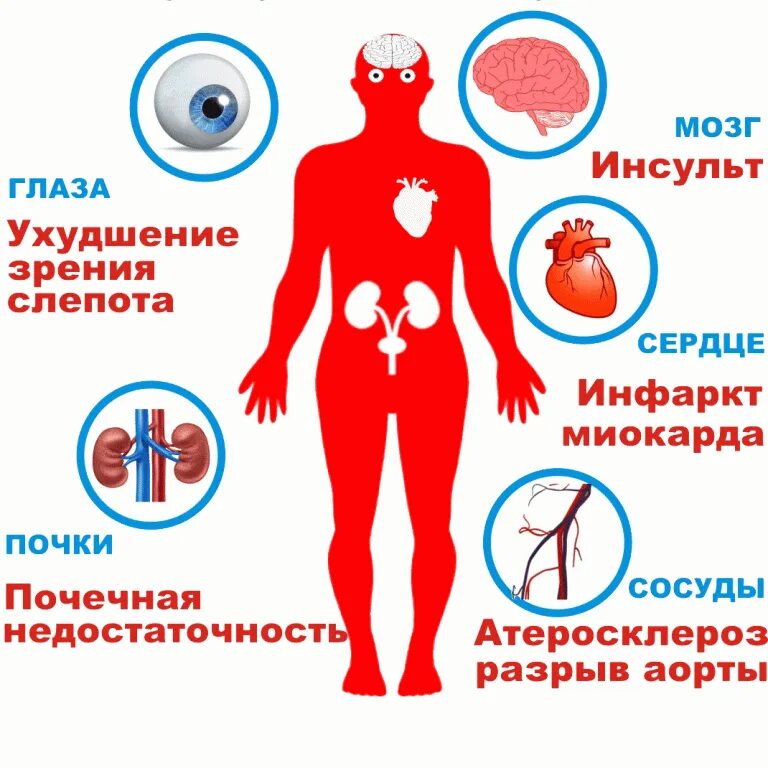 Симптомы повышено давления. Гипертония. Артериальная гипертензия. Заболевания артериального давления. Артериальная гипертония.