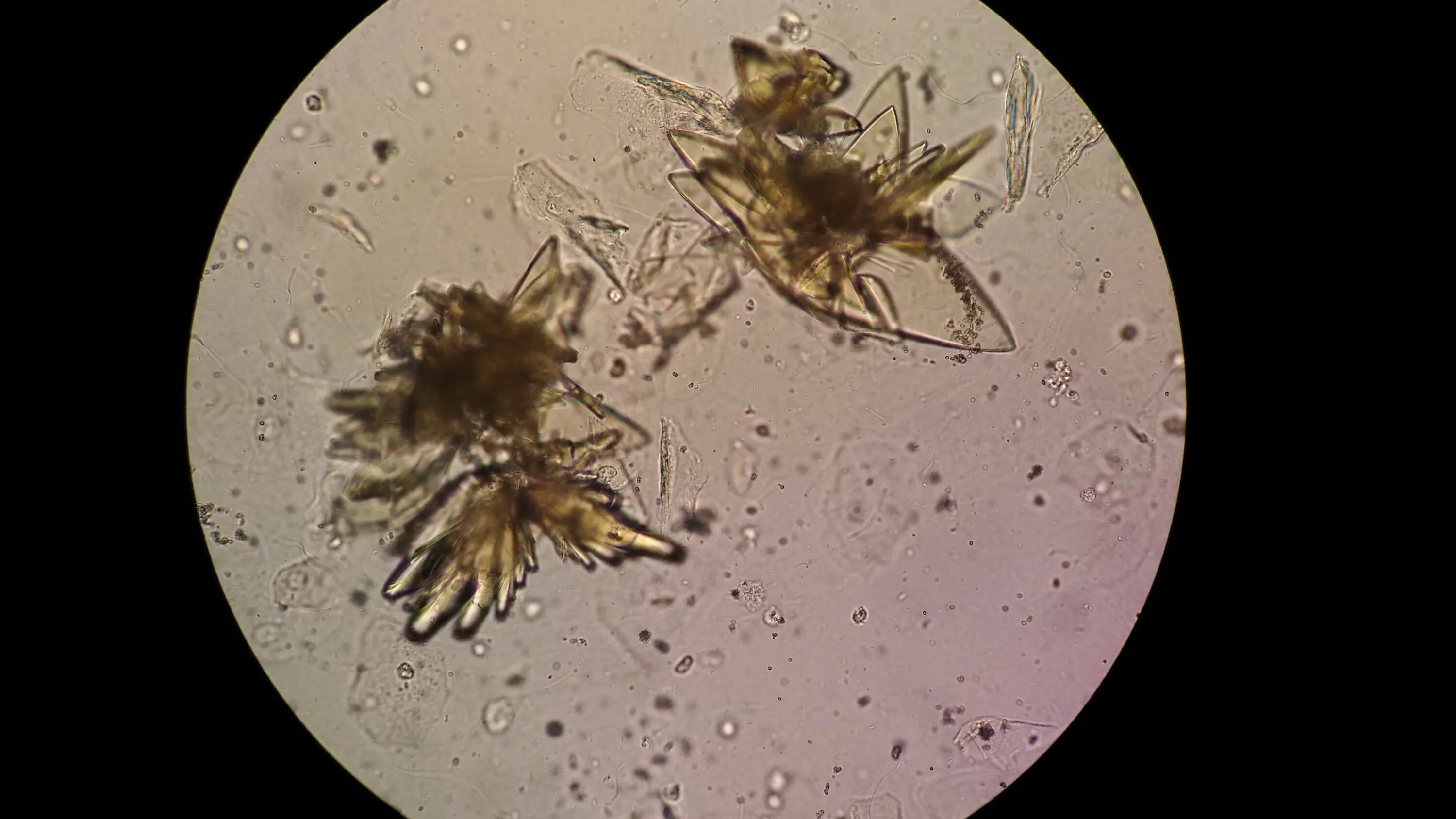 Под микроскопом. Микроорганизмы под микроскопом. Слюна под микроскопом. Бактерии в моче под микроскопом. Бактерии в слюне