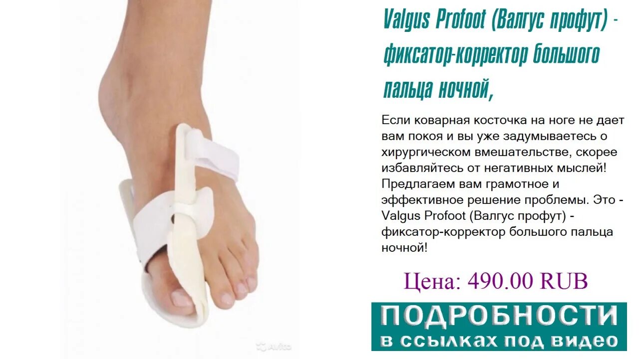 Comforma soft splint корректор отводящий первого пальца стопы ночной (с 3012). Самый эффективный корректор для большого пальца ноги. Фиксатор гелевый, вальгусный, бандаж корректор большого пальца ноги. Фиксатор для hallux valgus. Халюс вальгус ортез.