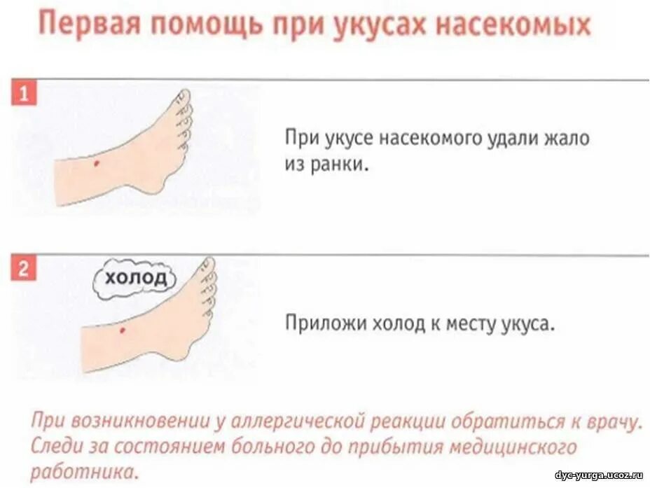 Первая помощь при укусе медузы. Первая помощь при укусе медузы