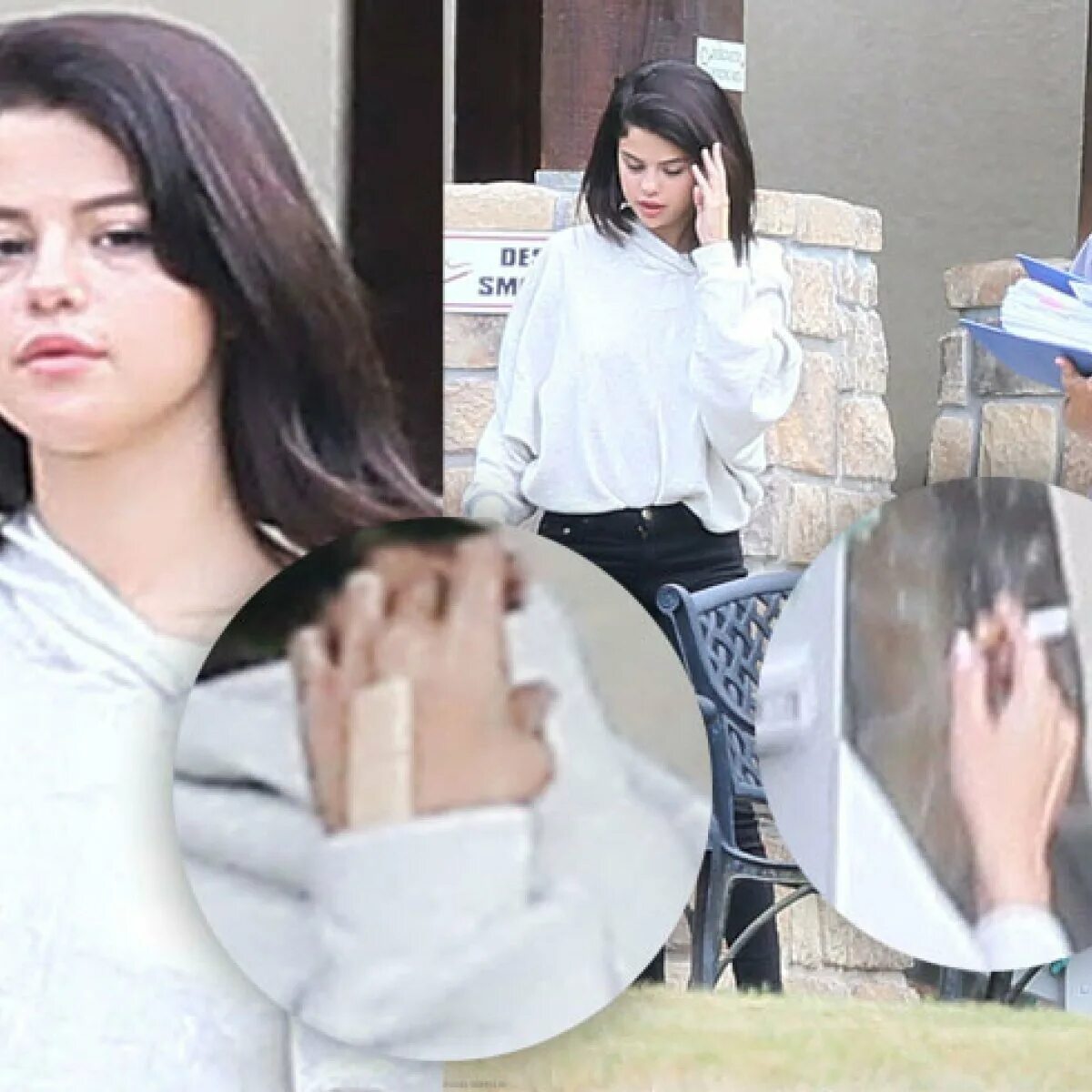 болезнь селены гомес