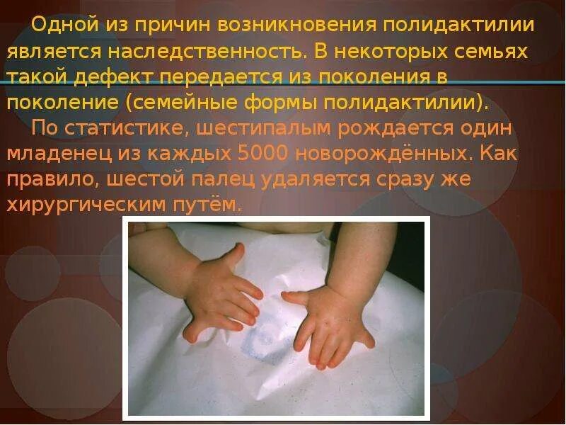 У человека шестипалость является. Полидактилия тип наследования. Малых коренных зубов у человека. У человека ген полидактилии доминирует над нормальным. У человека шестипалость является.