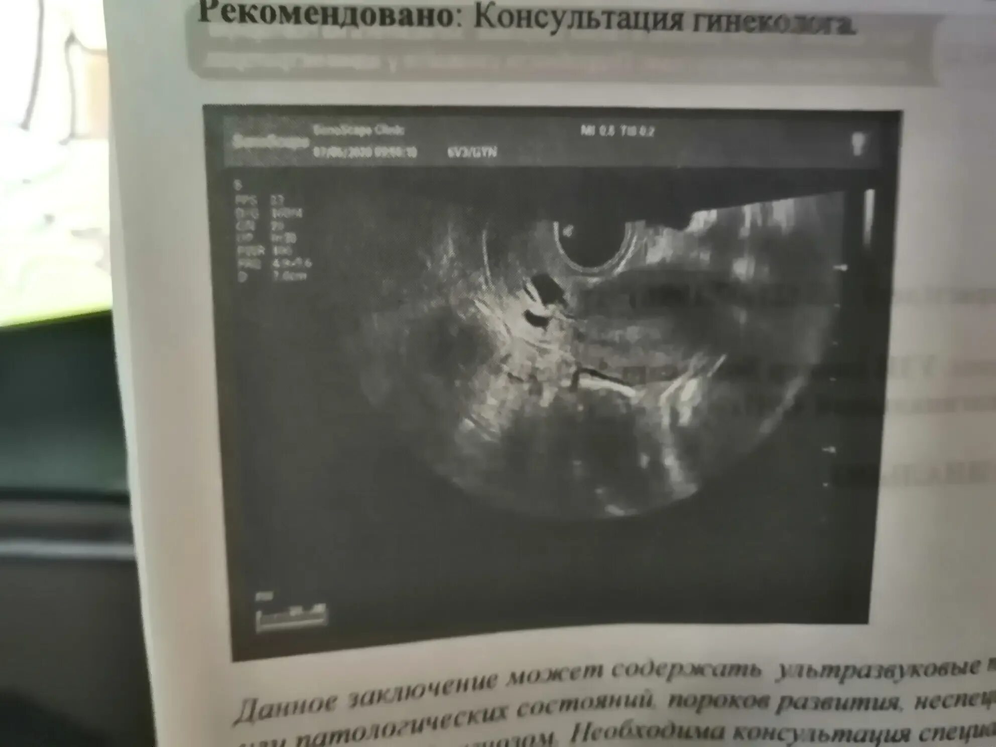 Узи ошиблось с полом форум. Узи ошиблось с полом форум