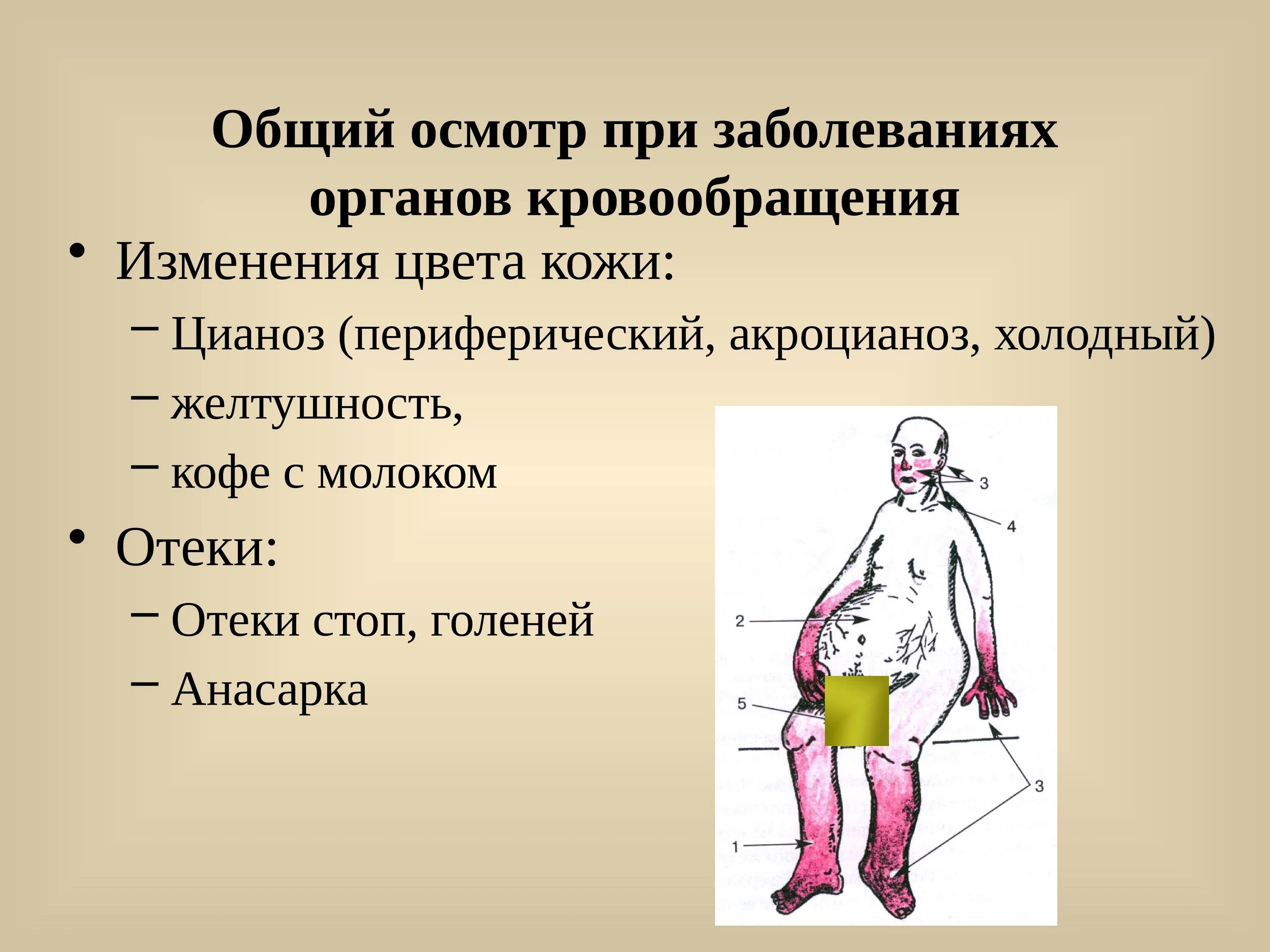 Заболевание нарушение кровообращения сосудистое. Осмотр больных с заболеваниями органов кровообращения. методы обследования пациента с патологией органов кровообращения.