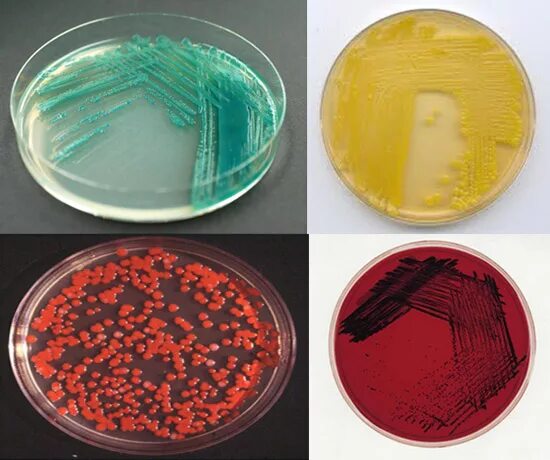 Бактерии в жидкой среде. Синегнойная палочка в чашке Петри. Pseudomonas aeruginosa на чашке Петри. Пигменты синегнойной палочки. Pseudomonas aeruginosa микробиология.