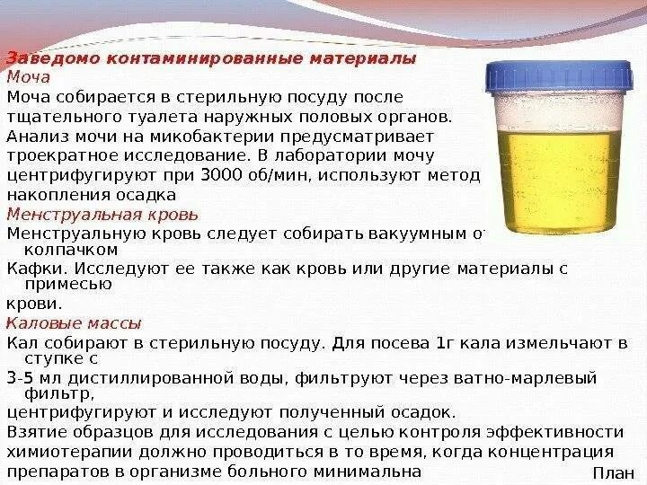 Как отличить мочу