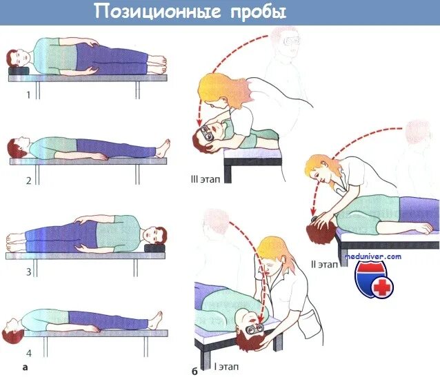 Проба холпайка. ДППГ нистагм. Позиционная проба Дикса Холпайка. ДППГ пробы позиционные. Позиционная проба вестибулярная.