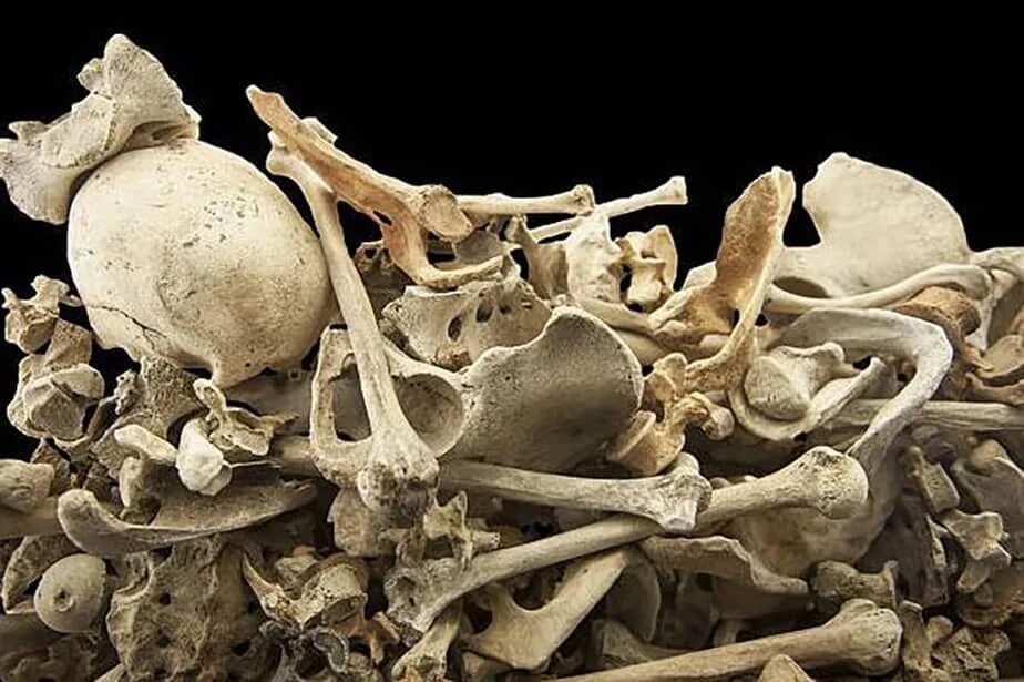 Кости человека. Куча человеческих костей.