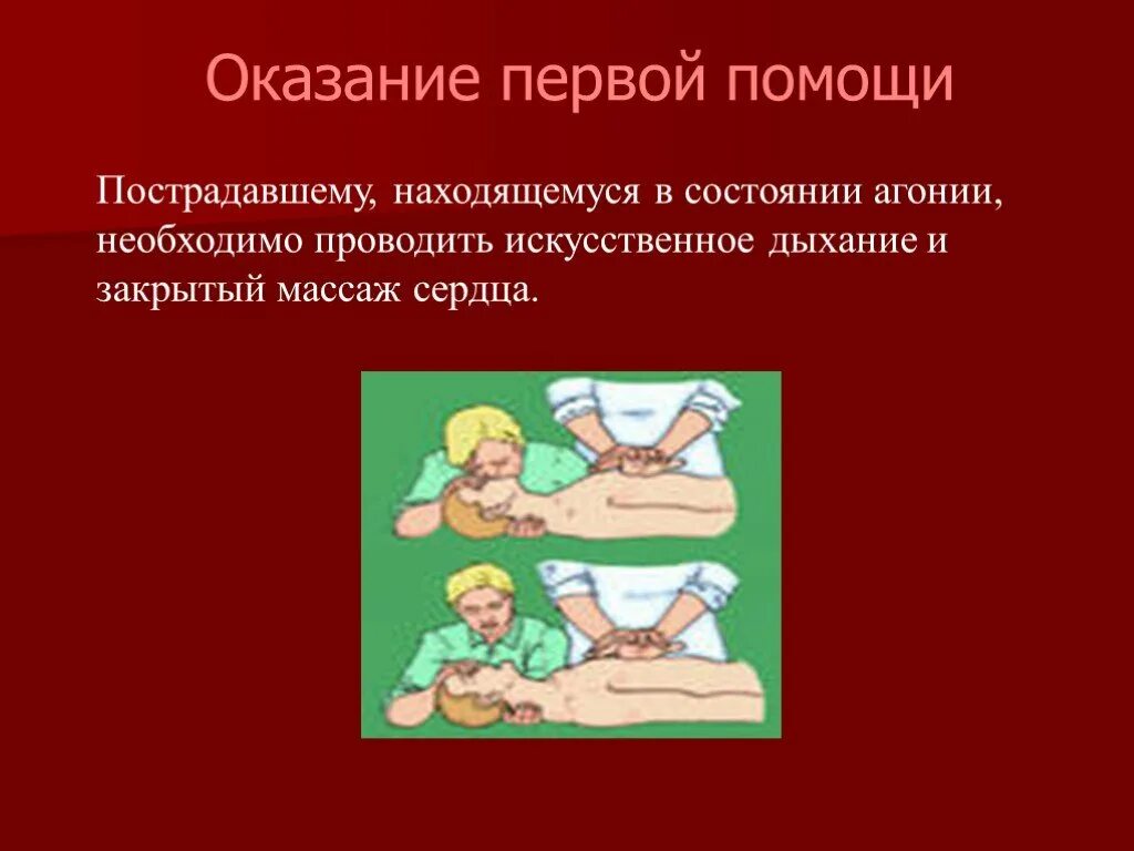 Оказание первой помощи. Искусственное дыхание и закрытый массаж сердца. Терминальное состояние ОБЖ. Агональное состояние первая помощь.