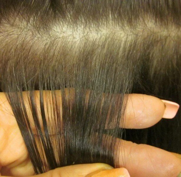Выпадают нарощенные волосы. Наращивание волос. Последствия наращивания волос. Капсульное наращивание волос. Волосы после наращивания.