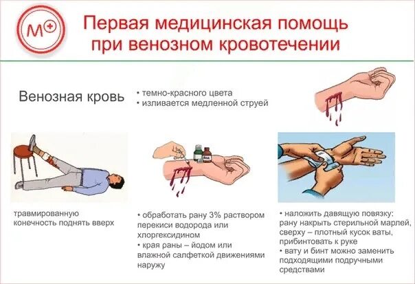1 помощь при артериальном кровотечении конечностей. Оказание первой помощи при венозном кровотечении. первая помощь при венозном кровотечении алгоритм. пмп при венозном кровотечении. алгоритм оказания пмп при венозном кровотечении.
