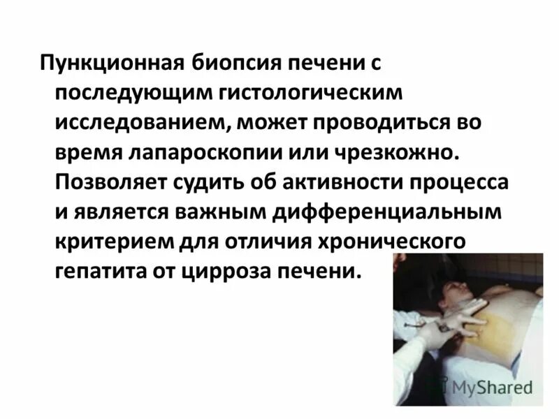 биопсия печени метастазов. биопсия печени метастазов. пункционная биопсия печени при гепатите. биопсия печени метастазов. биопсия печени при циррозе заключение.
