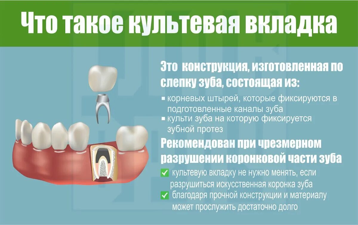 Через сколько можно вставить зубы. Культевая вкладка в стоматологии ортопедическая. Как устанавливается вкладка под коронку. Что такое вкладка для зубной коронки.