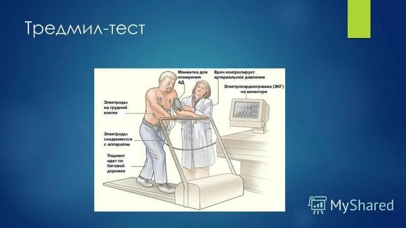 Тредмил тест экг. Тредмил-теста. Pwc170 велоэргометрия. Тредмил тест на беговой дорожке. Тредмил тест.