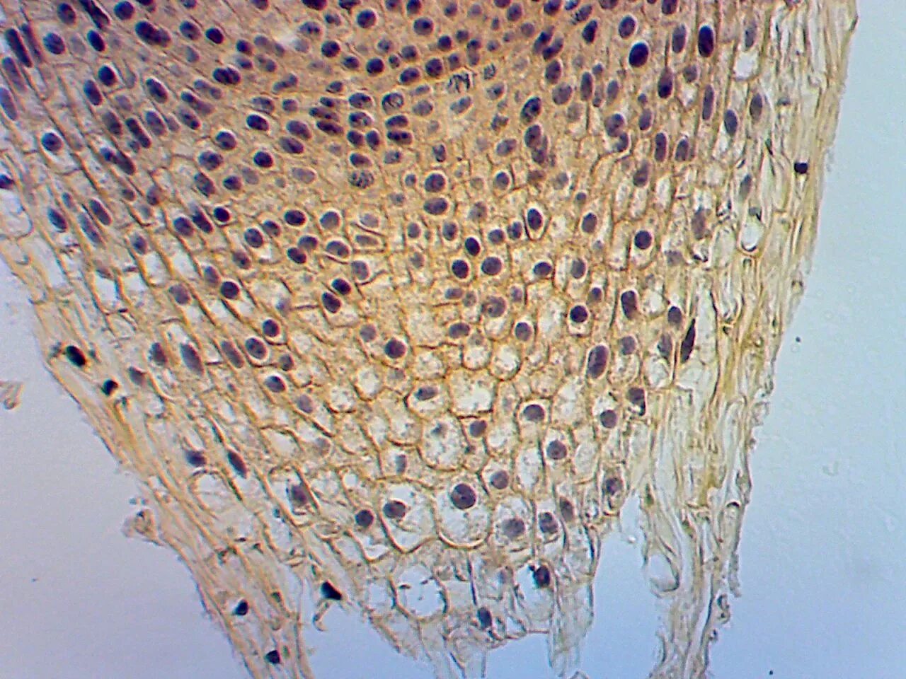 Корневой кончик. Корневой чехлик микроскоп. Корневой чехлик под микроскопом. Корневой чехлик микропрепарат.