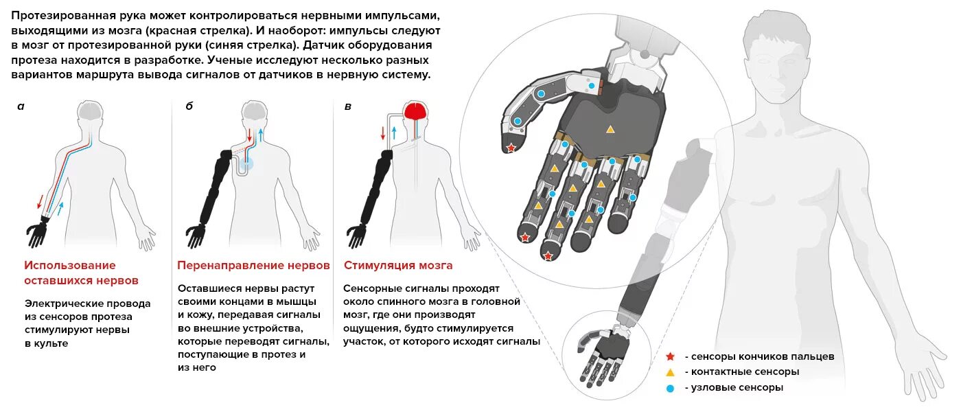 Управление импульс мозга. Схема работы бионического протеза. Бионический протез управляемый мозгом. Схема бионического протеза руки. Бионический протез предплечья.