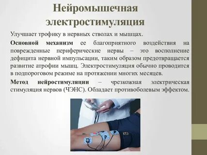Нейромышечная связь