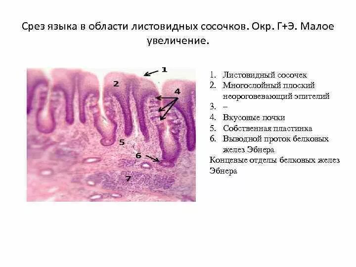 Листовидные сосочки гистология препарат. Вкусовые луковицы в листовидных сосочках языка гистология. Язык срез. Эпителий языка гистология. Листовидные сосочки языка рисунок гистология.