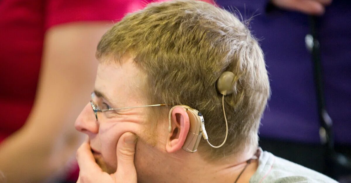Слабослышащие 2.2. Кохлеарный имплант аппарат. Кохлеарная имплантация Cochlear. Аппарат для глухих кохлеарная имплантация. Кохлеарный имплант Кохлер.