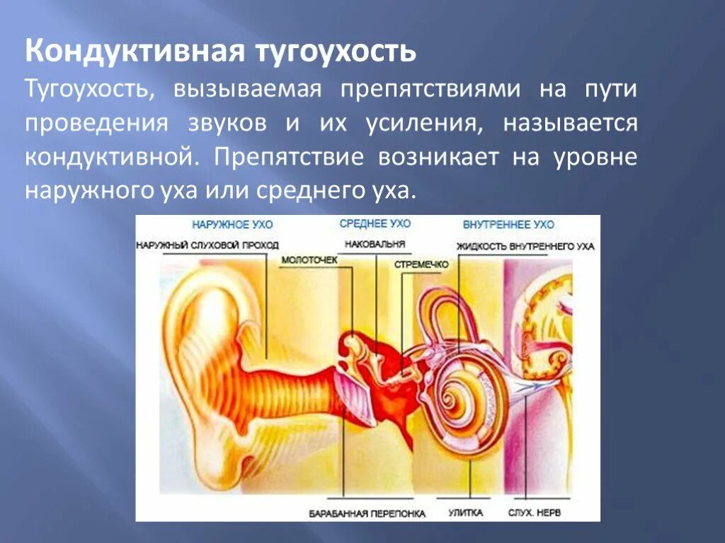 Среднее нарушение слуха. Кондуктивная и сенсоневральная тугоухость. Несиндромальная нейросенсорная тугоухость. Сенсоневральная тугоухость 4 степени. Тугоухость ослабление слуховой функции.