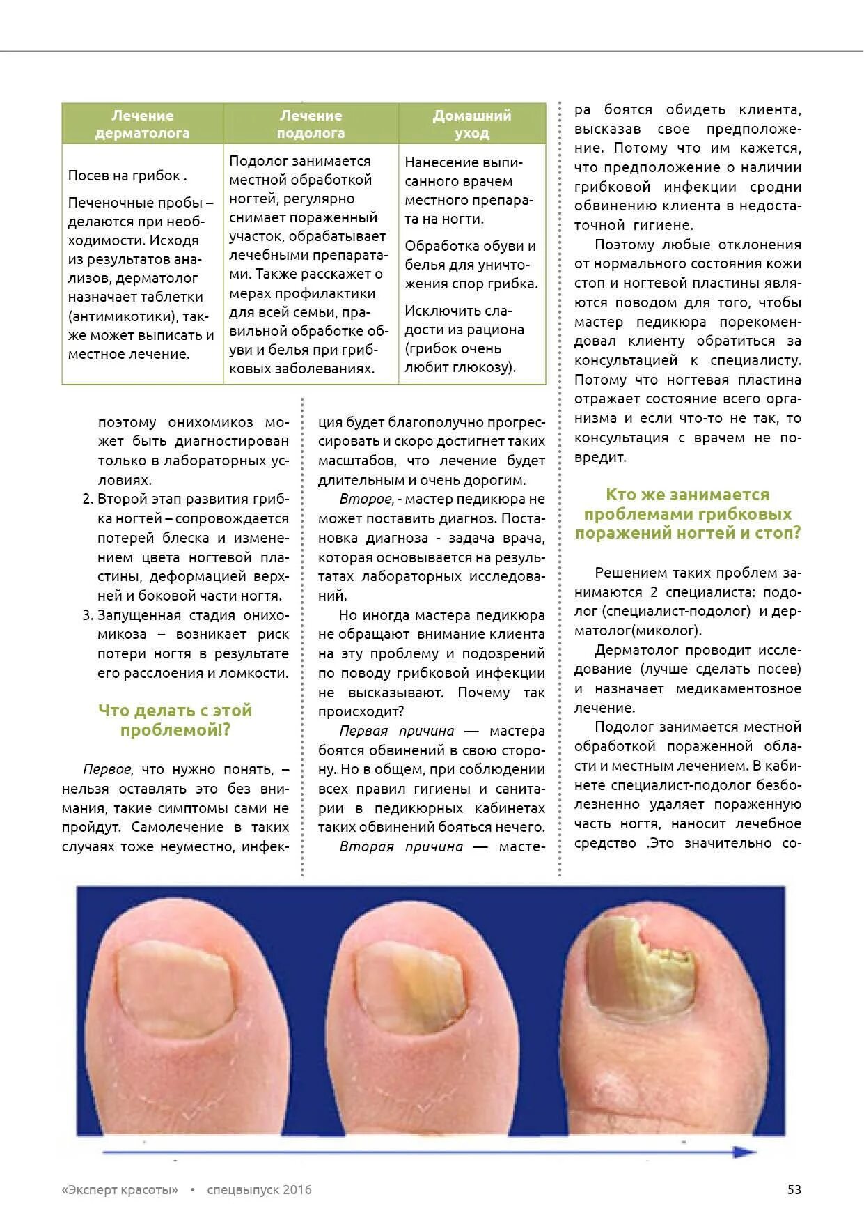 Соберите информацию о грибковых заболеваниях. Грибковые заболевания ногтей схема. Схема лечения (онихомикоз) онихомикоз ногтей. Онихомикоз ( обработка грибковых ногтей). Схема лечения грибкового поражения ногтей.