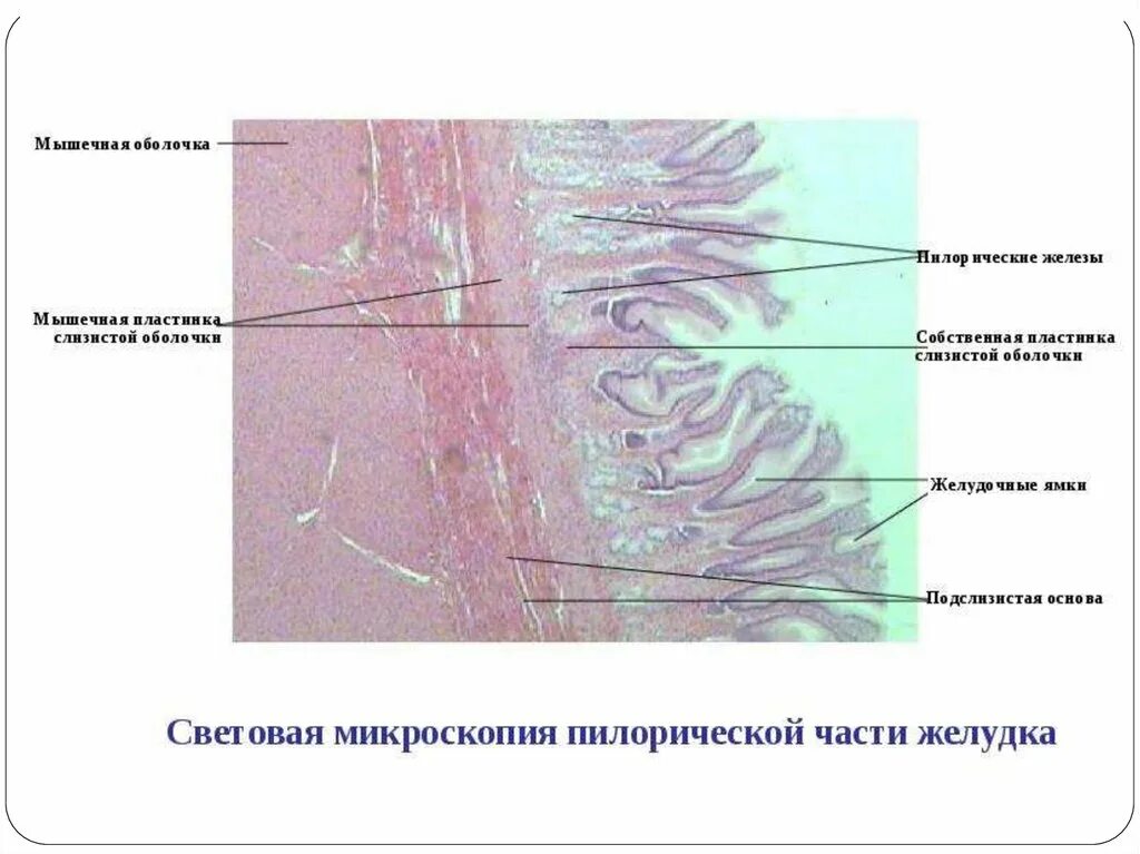 Мышечная оболочка пилорического отдела желудка. Пилорический отдел желудка гистология препарат. Пилорические железы строение. Собственная пластинка слизистой оболочки желудка. Слизистый на латинском