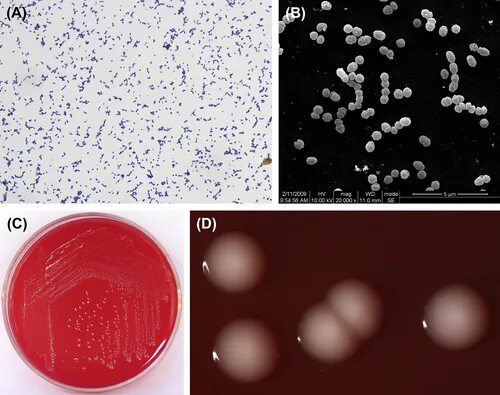 Peptostreptococcus anaerobius. Пептострептококки микробиология. Peptostreptococcus anaerobius 18623. Пептококкус нигер.